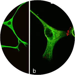 Plakophilin-2 - Protein