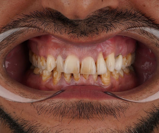 Porta group health tourism - Health consultant in Istanbul