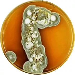 Pseudogymnoascus destructans