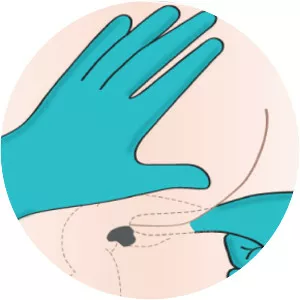 Rectal administration - 