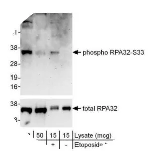 Replication protein A2 - 
