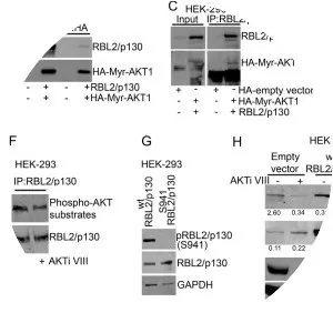 Retinoblastoma-like protein 2 - 