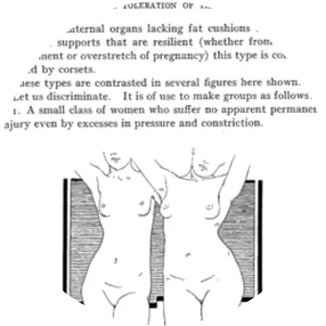 Robert Latou Dickinson