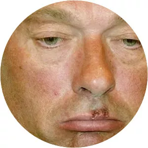 Ronald Schill - Former Second Mayor of Hamburg