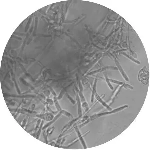 Schizosaccharomyces