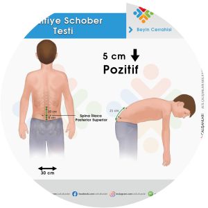 Schober