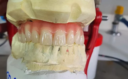 Sciarretta Lab Riparazione e Costruzione Protesi