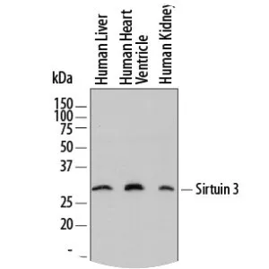 Sirtuin 3 - Protein