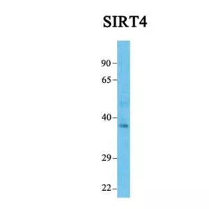 Sirtuin 4 - Protein