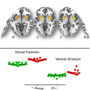 Statistical parametric mapping