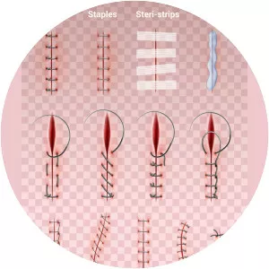 Surgical suture - 