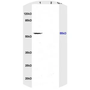TGF beta receptor 1 - Protein