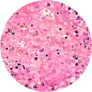 Third plague pandemic photograph