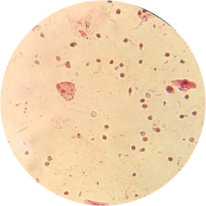 Trichur Elsi photograph