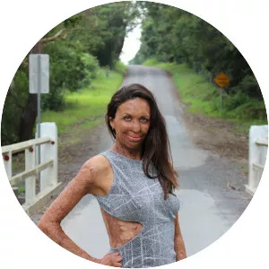 Turia Pitt