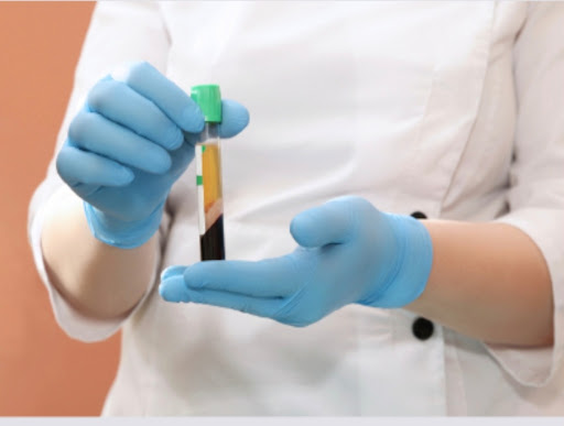 Uroloh Vintoniv, Okl - Urologist in Ivano-Frankivsk, Ukraine